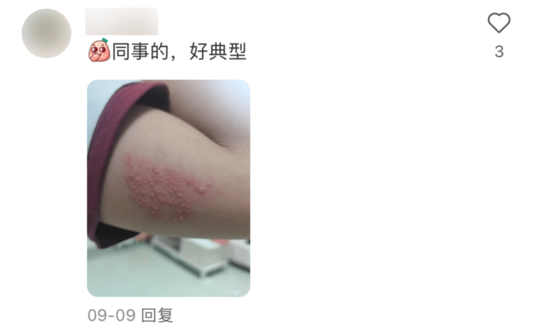 一旦感染终身携带<strong></p>
<p>集合理财</strong>！深圳疾控提醒：这4类人要注意