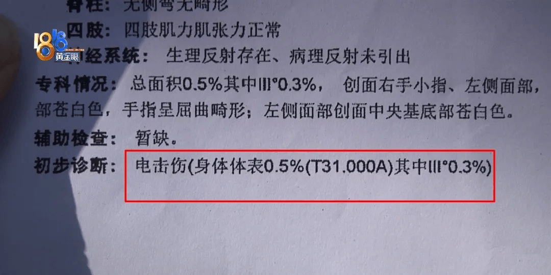 5岁男童瞬间晕厥<strong></p>
<p>公司理财答案</strong>，筋都断了！街上常见，看见立即远离