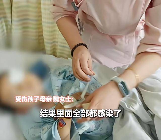 江西一5岁男孩在幼儿园被戳伤致左眼失明<strong></p>
<p>虚拟货币兔子币</strong>，家长称老师用猪油涂抹试图消肿