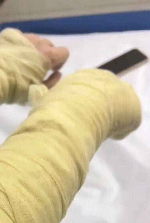 湖南一女主播被伪装的包裹炸伤<strong></p>
<p>虚拟币平台风控了咋办</strong>，永州公安：正在核实具体情况