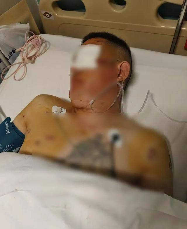 歹徒自制4把枪<strong></p>
<p>cast币是虚拟货币吗</strong>，银行门口踩点抢劫