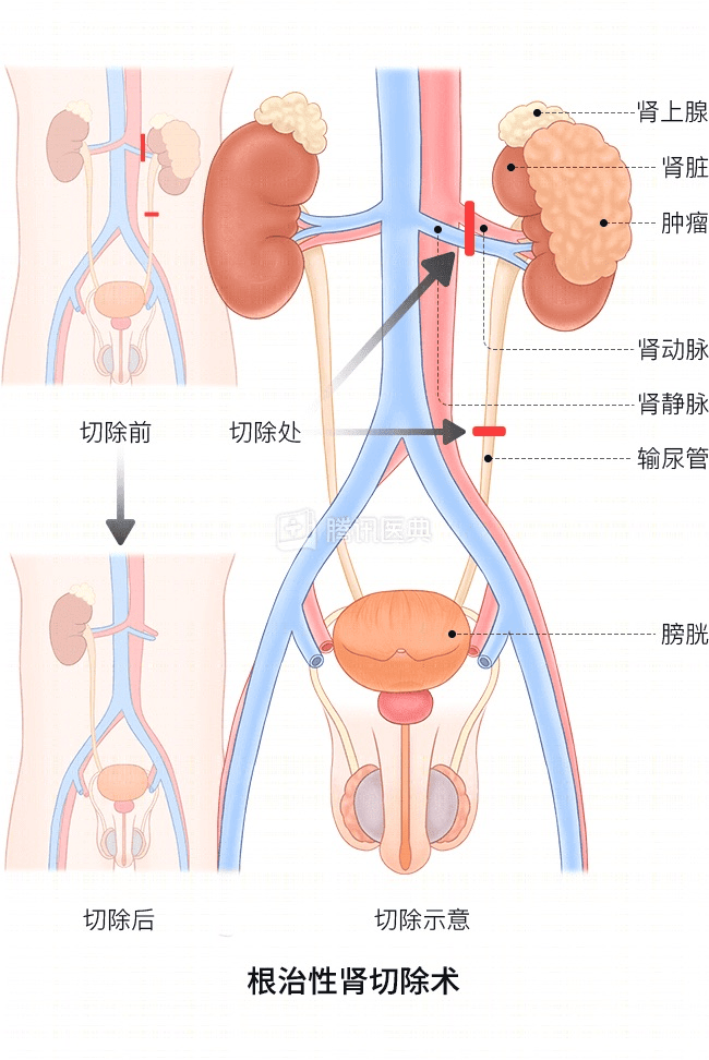 “感觉天塌了”！深圳女孩5岁患癌<strong></p>
<p>有哪些币值得推荐</strong>，爸妈决定：为她冻存卵巢组织